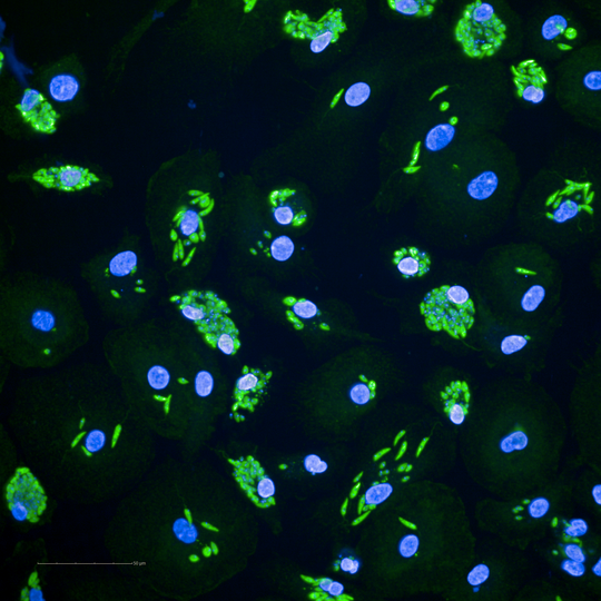 LeishmanieninfizierteFluorescence image of human macrophages infected with Leishmania. Zellen_DAPI.png Mikroskopische Fluoreszenzaufnahme von humanen Makrophagen, die mit Leishmanien infiziert sind.