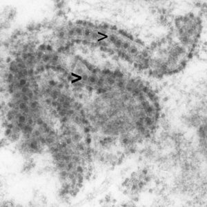 Elektronenmikroskopisches Bild von West-Nil-Viren