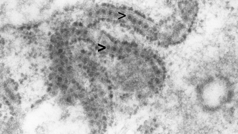 Elektronenmikroskopisches Bild von West-Nil-Viren