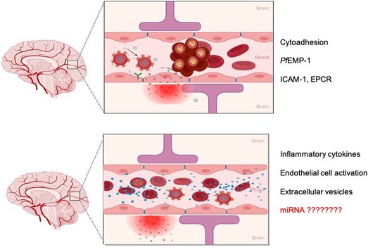 Illustration of the Theories of complications during P. falciparum infection? Theories of complications during P. falciparum infection