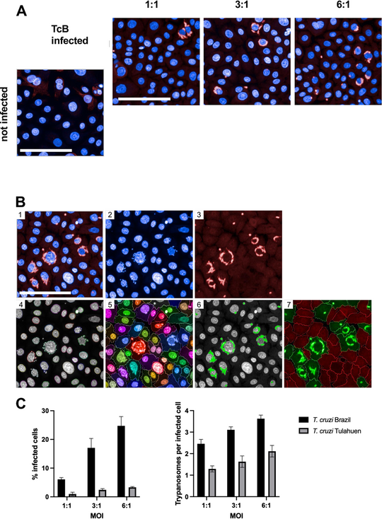 Infektion von Keratinozyten mit unterschiedlichen Mengen von T. cruzi A) Vier Fluoreszenzaufnahmen, die Hautzellen zeigen, die mit unterschiedlichen Mengen an T. cruzi infiziert sind. B) Bildsequenzanalyse von Keratinozyten, die mit T. cruzi Brazil infiziert sind. C) Balkendiagramme, die Infektionsraten (links) und durchschnittliche Anzahl der Parasiten pro infizierter Keratinozytenzelle (rechts) bei verschiedenen Mengen an zugegebenen Parasiten der Stämme T. cruzi Brazil und T. cruzi Tulahuen zeigen.
