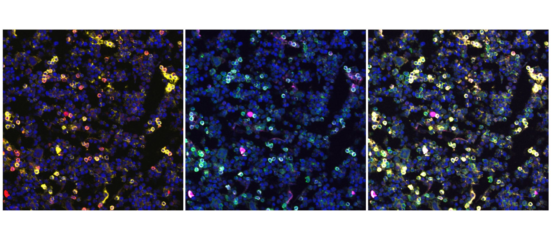 Fluorescent imaging of developing B cells in murine bone marrow.