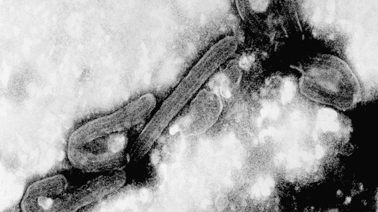 Electron microscopy of Marburg viruses Black and white Electron microscopy of Marburg viruses