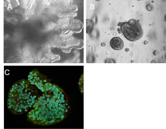Microscopic images of iPSCs derived Organoids Figure A shows a microscopic transmitted light image of a lung organoid in different shades of grey. It looks three-dimensional, appearing somewhat more compact in the centre and branching out like algae towards the edge. Figure B shows roundish liver organoids also in different shades of grey. They have different sizes, a darker border and roundish bulges. Figure C shows a fluorescence image of a liver organoid. There are many blue coloured roundish structures surrounded by green colour in this organoid, with scattered red dots on the outside. The background is black.