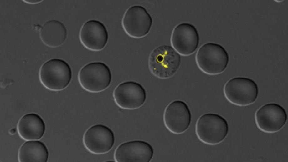 Fluoreszente Malariaparasiten Fluoreszente Malariaparasiten: Graues Bild mit grauen Zellen und gelb leuchteten Malaria-Parasiten