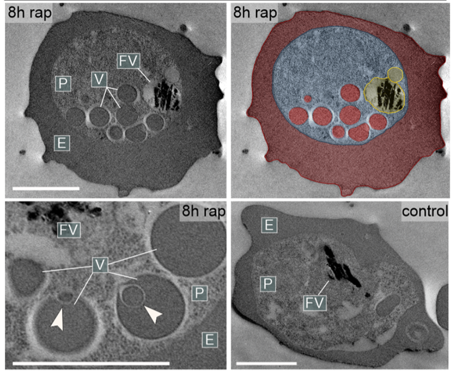 Elektronenmikroskopische Aufnahmen der Vesikel, die nach Entfernung von Rabenosyn-5 entstehen (8h rap) (oben rechts mit falscher Färbung). Unten rechts Kontrollbild, in dem Rabenosyn-5 funktioniert.