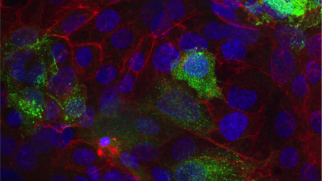 SARS-CoV-2 infected vero cells with stained, bound SARS-CoV-2 monoclonal antibody 5D4.