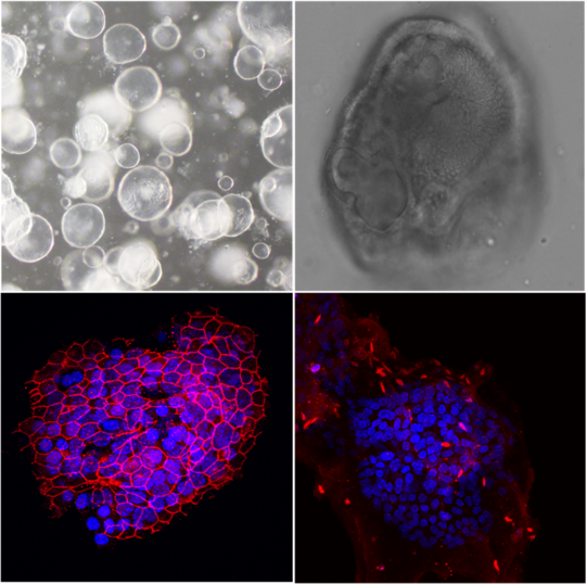 Microscopic images of hepatic organoids. The picture shows four microscopic images of murine liver organoids. Two images show transmitted light images, two other images show fluorescence images with co-cultured Leishmania .