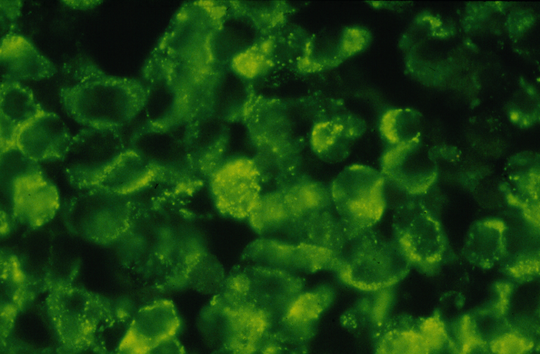 Elektronenmikroskopisches Bild von Dengue-Viren Das elektronenmikroskopische Foto zeigt eine Vielzahl rundlicher hellgrüner Dengue-Viren vor schwarzem Hintergrund.