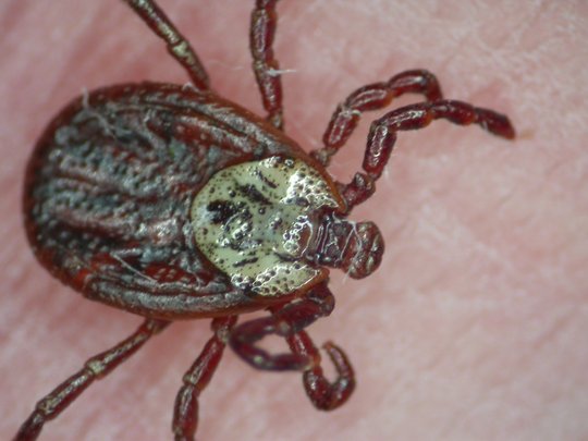 Dermacentor reticulatus Dermacentor Reticulatus leicht von frontal schräg oben auf der Haut eines Menschen.