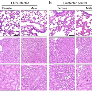 Histologisches Bild von Lunge, Leber und Niere