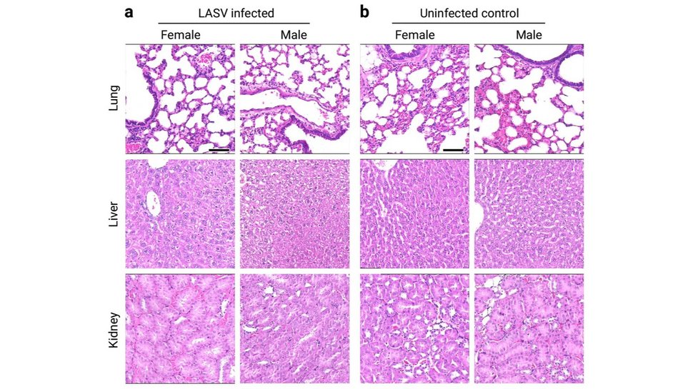 Histologisches Bild von Lunge, Leber und Niere