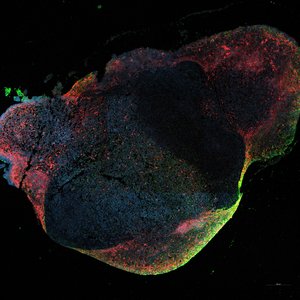 Hirnorganoid Das Foto zeigt eine Fluoreszenzaufnahme von einem Hirnorganoid, das mit dem Ebola-Virus infiziert ist. Das Organoid ist in verschiedenen Farben angefärbt, das Ebola-Virus leuchtet grün, Nervenzellen rot und Zellkerne blau..