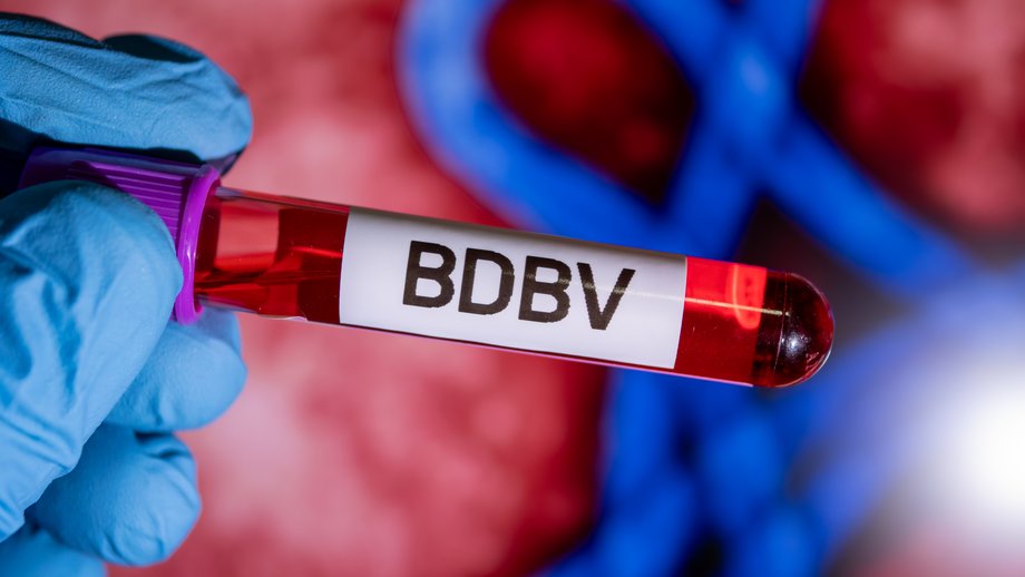 Bundibugyo-Virus-Ausbruch in der Demokratischen Republik Kongo Das Foto zeigt eine Hand mit blauen Laborhandschuhen, die ein Probenröhrchen mit der Aufschrift BDBV hält. Im Hintergrund eine blau-rot gefärbte elektronenmikroskopische Aufnahme von Ebola-Viren.