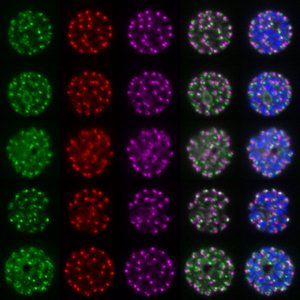 Fluorescent malaria parasites Microscopic images of malaria parasites fluorescing in different colours (blue, red, green, yellow), depicted against a black background. Additional light microscope images can be seen on the left and right, with an overlay of the fluorescence staining on the right.