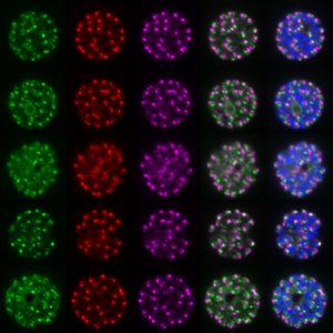 Fluoreszierende Malariaparasiten Mikroskopische Aufnahmen von in verschiedenden Farben (blau, rot, grün, gelb) fluoreszierenden Malariaparasiten, abgebildet vor schwarzem Hintergrund. Links und rechts sind zusätzliche lichtmikroskopische Aufnahmen zu sehen, rechts zusätzlich eine Überlagerung mit der Fluoreszenzfärbung.