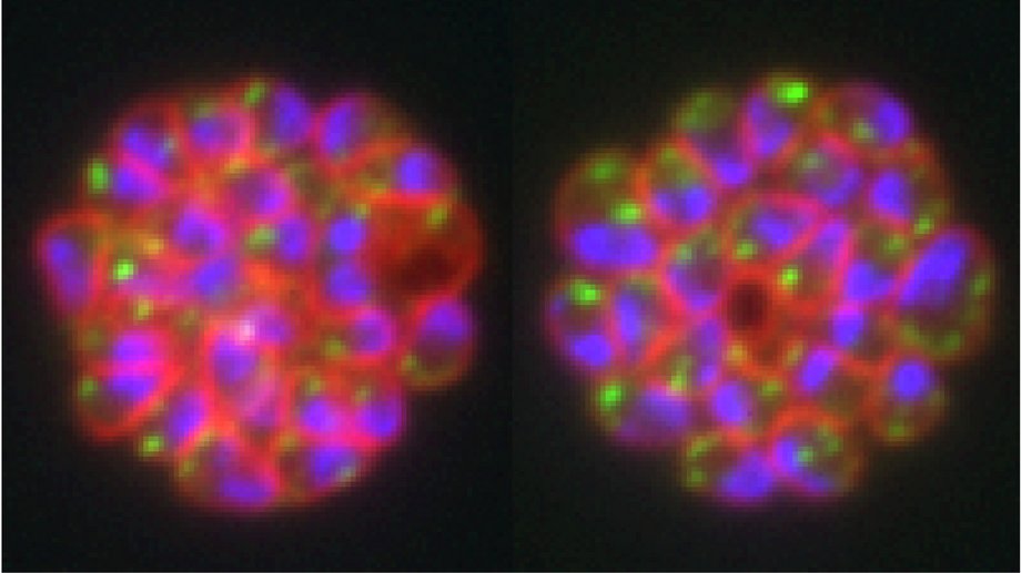 Färbungen des Malariaparasiten Zwei Fluoreszenzaufnahmen in magenta, grün und blau vom Malariaparasiten