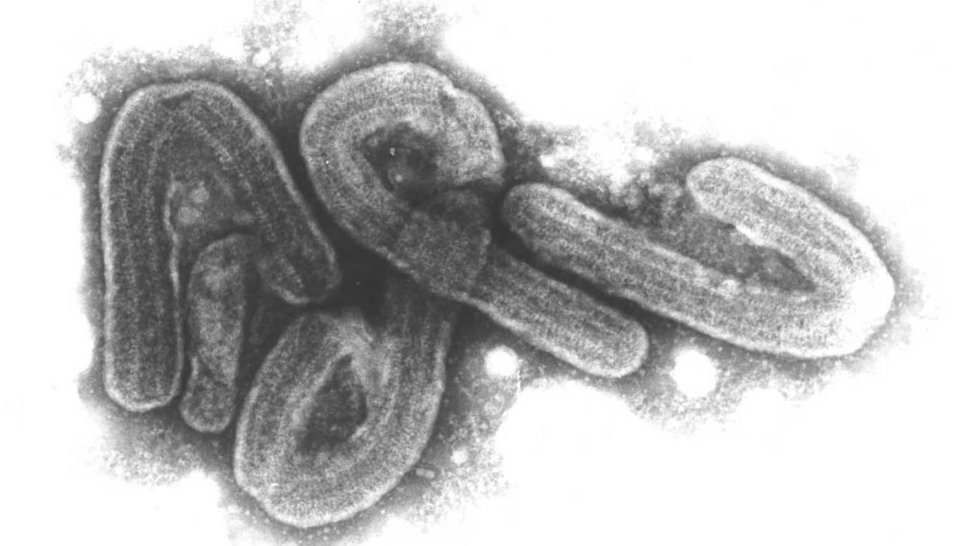 Electron microscopic black and white image of Marburg viruses Electron microscopic image of Marburg viruses