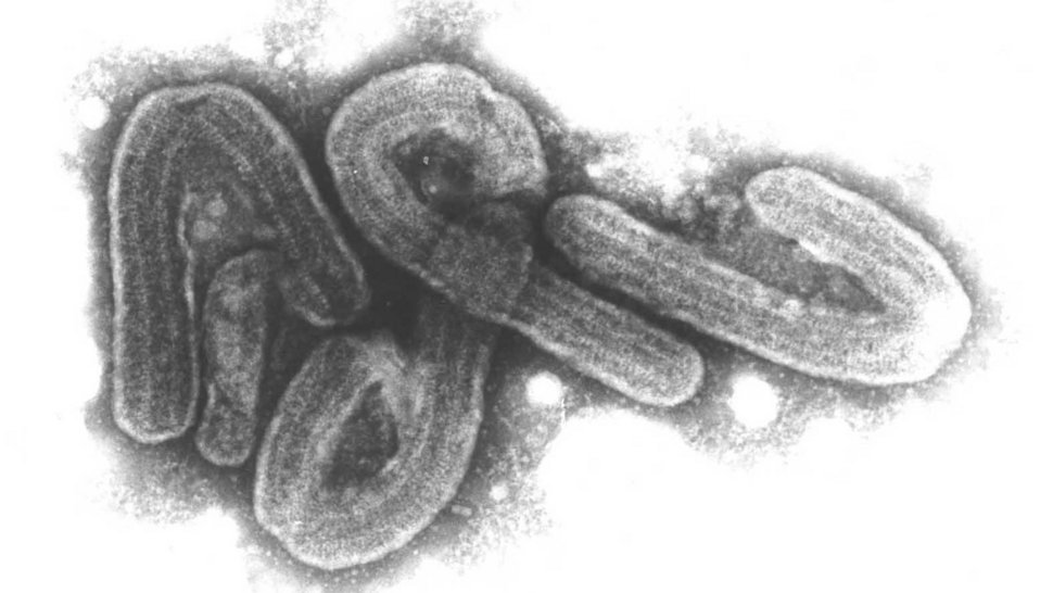 Electron microscopic black and white image of Marburg viruses