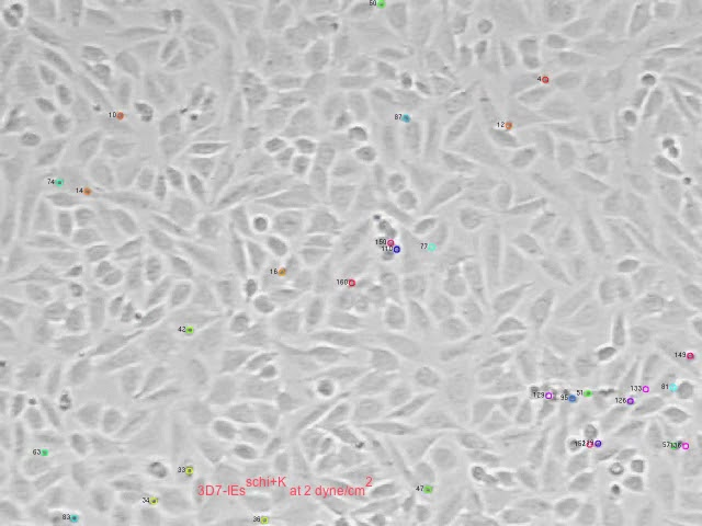 Grey electron microscope movie taken in the S4-Lab showing cells and parasites __row|uid_local|metadata|alternative