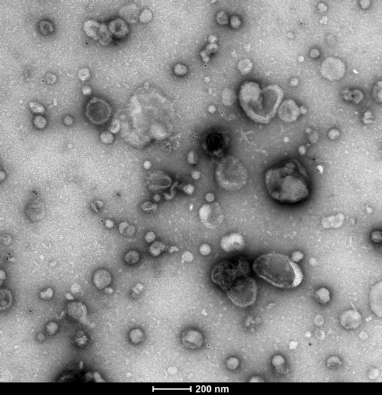 Transmission electron microscopy of extracellular vesicles. Zu sehen ist eine Transmissionselektronenmikroskopie von extrazellulären Vesikeln der Amöben: ein Bild in grauen Tönen gehaltet zeigt unterschiedlich große und willkürlich über das Bild verteilte unregelmäßige Kreise. Am unteren Rand steht auf einem schwarzen Balken ein Pfeil mit der Größeneinheit 200nm.