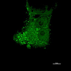 Fluoreszenzmikroskopisches Bild von grünlich leuchtenden Nipah-Viren