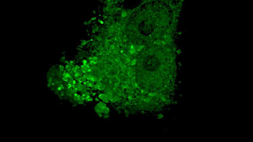 Fluoreszenzmikroskopisches Bild von grünlich leuchtenden Nipah-Viren