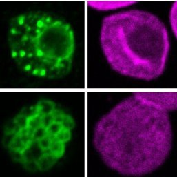 Fluoreszenzaufnahme des Malariaparasiten in roter Blutzelle Fluoreszenzaufnahme zeigt den Malariaparasiten in einem vielkernigen Entwicklungsstadium, wie er rote Blutzellen befallen hat.