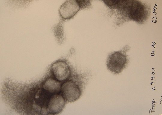 Electron microscope image of Mpox A microscopic image of monkeypox is shown. In the lower part of the image, an accumulation of four, roundish, grey-black viruses can be seen.