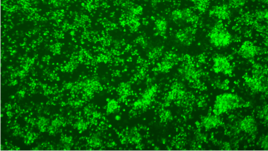 Dengue immunofluorescence Colorful close up of viruses