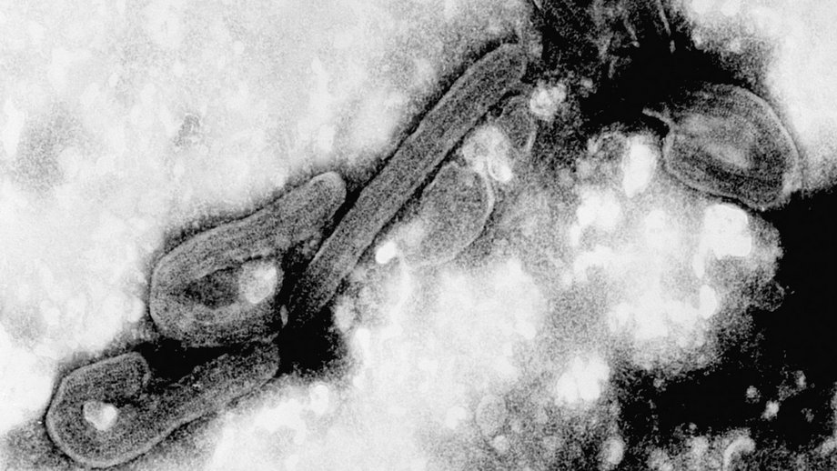 Elektronenmikroskopische Aufnahme des Marburg-Virus in schwarz weiß.