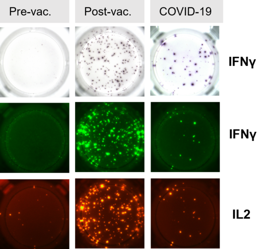 T cell Elispot before and after vaccination T Zellen Elispot: zu sehen sind mehre kleine Bilder, die eine Probe pre, post und Covid-19 darstellt. in der oberen Reihe sieht man bei IFNg ein durchsichtiges Well mit unterschiedlichen vielen und großen lila Punkten (die meisten bei COVID-19), darunter ein Bild (IFNg) mit schwarzem Hintergrund und grünen Punkten, die meisten Punkte bei Post-vac. In der letzten Reihe IL-2, ebenfalls mit schwarzem Hintergrund und roten Punkten. Die meisten Punkte sind bei Post-vac zu sehen.