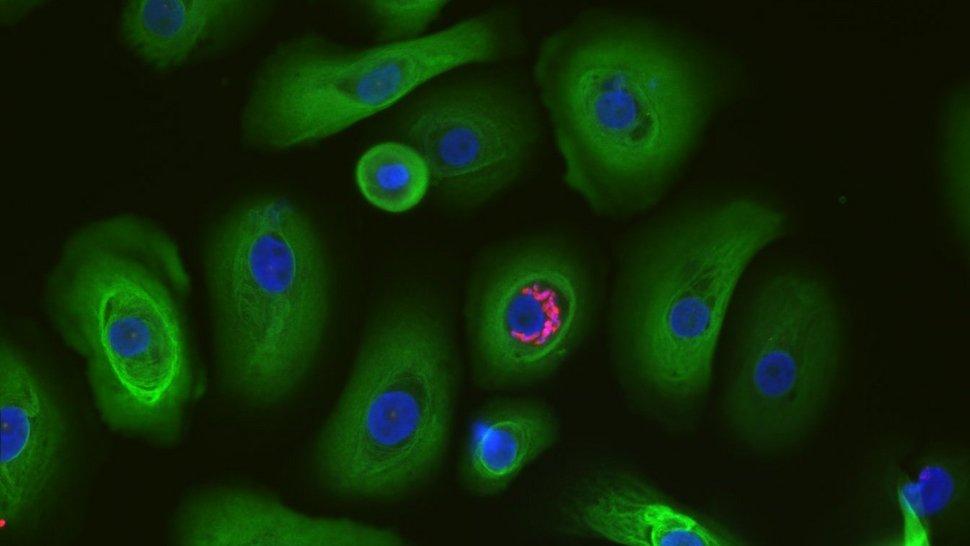 Fluoreszenzaufnahme zeigt grüne Hautzellen, die Zellkerne sind blau gefärbt. Eine Hautzelle ist mit Trypanosoma cruzi infiziert, T. cruzi ist rot angefärbt. Der Hintergrund ist schwarz.