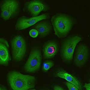 Fluoreszenzaufnahme zeigt grüne Hautzellen, die Zellkerne sind blau gefärbt. Eine Hautzelle ist mit Trypanosoma cruzi infiziert, T. cruzi ist rot angefärbt. Der Hintergrund ist schwarz.